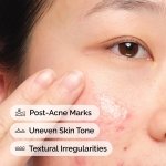 The Ordinary Aloe 2% + NAG 2% Solution, Soothes Skin and Targets Post-Acne Marks, 1 Fl Oz - Image 4