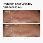 The Ordinary Niacinamide 10% + Zinc 1%, Smoothing Serum for Blemish-Prone Skin, 1 Fl Oz - Image 2